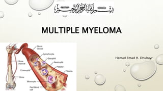 MULTIPLE MYELOMA
Hamad Emad H. Dhuhayr
 