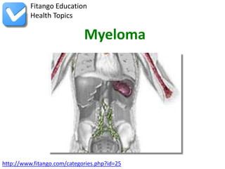 Fitango Education
          Health Topics

                             Myeloma




http://www.fitango.com/categories.php?id=25
 
