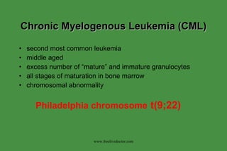 Chronic Myelogenous Leukemia (CML) second most common leukemia middle aged  excess number of “mature” and immature granulocytes all stages of maturation in bone marrow chromosomal abnormality Philadelphia chromosome   t(9;22) www.freelivedoctor.com 
