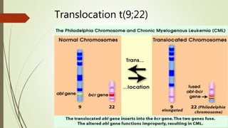 Translocation t(9;22)
 