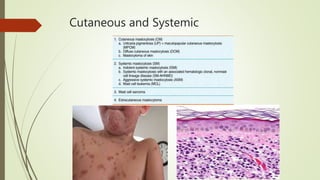 Cutaneous and Systemic
 