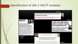 Identification of JAK-2 V617F mutation
 
