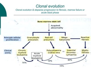 Clonal evolution
Clonal evolution & stepwise progression to fibrosis, marrow failure or
acute blast phase
 