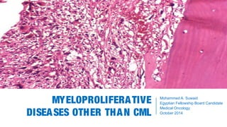 MYELOPROLIFERATIVE
DISEASES OTHER THAN CML
Mohammed A. Suwaid
Egyptian Fellowship Board Candidate
Medical Oncology
October 2014
 