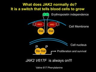JAK2
JAK2 V617F is always on!!!
What does JAK2 normally do?
It is a switch that tells blood cells to grow
JAK2
StatStat
StatStat Proliferation and survival
P P
Cell Membrane
Cell nucleus
Erythropoietin independence
Valine 617 Phenylalanine
 
