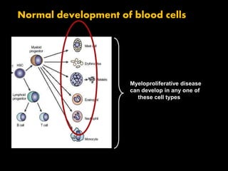 Myeloproliferative disease
can develop in any one of
these cell types
Normal development of blood cells
 