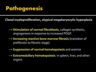 Clonal myeloproliferation, atypical megakaryocytic hyperplasia
→ Stimulation of normal fibroblasts, collagen synthesis,
angiogenesis in response to increased PDGF.
→ Increasing reactive bone marrow fibrosis (transition of
prefibrotic to fibrotic stage)
→ Suppression of normal hematopoiesis and anemia
→ Extramedullary hematopoiesis in spleen, liver, and other
organs
 