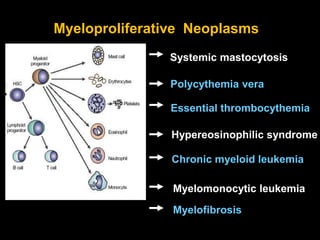 Systemic mastocytosis
Polycythemia vera
Essential thrombocythemia
Hypereosinophilic syndrome
Myeloproliferative Neoplasms
Chronic myeloid leukemia
Myelomonocytic leukemia
Myelofibrosis
 