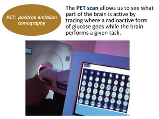 PET: positron emission
tomography

The PET scan allows us to see what
part of the brain is active by
tracing where a radioactive form
of glucose goes while the brain
performs a given task.

 