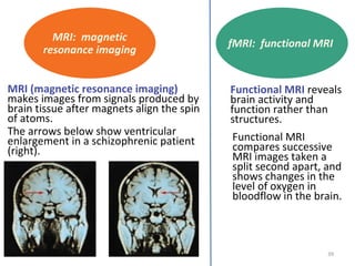 MRI: magnetic
resonance imaging
MRI (magnetic resonance imaging)
makes images from signals produced by
brain tissue after magnets align the spin
of atoms.
The arrows below show ventricular
enlargement in a schizophrenic patient
(right).

fMRI: functional MRI

Functional MRI reveals
brain activity and
function rather than
structures.
Functional MRI
compares successive
MRI images taken a
split second apart, and
shows changes in the
level of oxygen in
bloodflow in the brain.

39

 