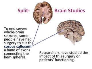 SplitTo end severe
whole-brain
seizures, some
people have had
surgery to cut the
corpus callosum,
a band of axons
connecting the
hemispheres.

Brain Studies

Researchers have studied the
impact of this surgery on
patients’ functioning.

 