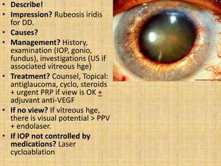 Subtle Rubeosis My experience in FRCS Glasgow ophthalmology | PPTX