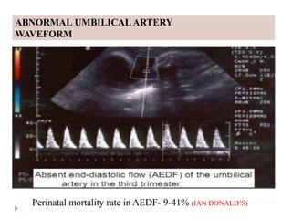 intra uterine fetal growth restriction | PPTX