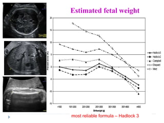 Hadlock Table intra uterine fetal growth restriction | PPTX