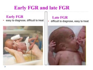 intra uterine fetal growth restriction | PPTX