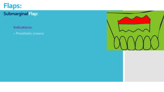 SubmarginalFlap:
Flaps:
Indications:
– Prosthetic crowns
 