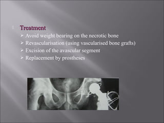 TreatmentTreatment
 Avoid weight bearing on the necrotic bone
 Revascularisation (using vascularised bone grafts)
 Excision of the avascular segment
 Replacement by prostheses
 