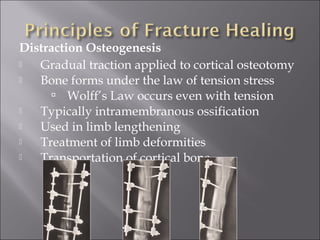 Distraction Osteogenesis
 Gradual traction applied to cortical osteotomy
 Bone forms under the law of tension stress
 Wolff’s Law occurs even with tension
 Typically intramembranous ossification
 Used in limb lengthening
 Treatment of limb deformities
 Transportation of cortical bone
 