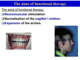 The aims of functional therapy
The aims of functional therapy:
Neuromuscular stimulation.
Normalization of the sagittal / relation.
Expansion of the arches.
 