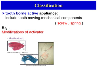  tooth borne active appliance:
include tooth moving mechanical components
( screw , spring )
E.g.:
Modifications of activator
Classification
 