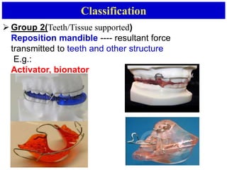 Classification
 Group 2(Teeth/Tissue supported)
Reposition mandible ---- resultant force
transmitted to teeth and other structure
E.g.:
Activator, bionator
Bionitor
 