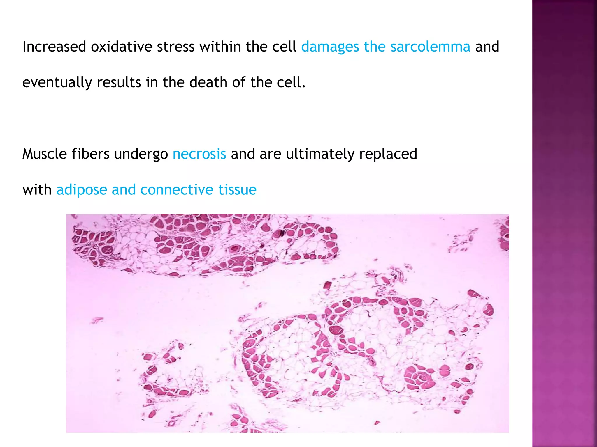 Increased oxidative stress within the cell damages the sarcolemma and 
eventually results in the death of the cell. 
Muscle fibers undergo necrosis and are ultimately replaced 
with adipose and connective tissue 
 