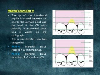 CLINICAL FEATURES OF GINGIVITIS AND ITS CORRELATION WITH MICROSCOPIC FINDINGS