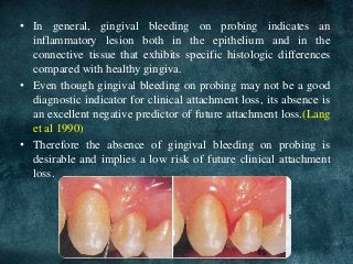 CLINICAL FEATURES OF GINGIVITIS AND ITS CORRELATION WITH MICROSCOPIC FINDINGS