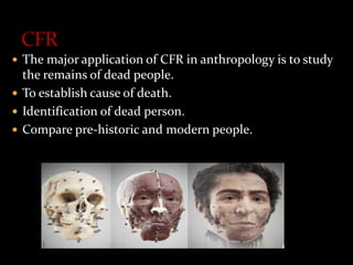  The major application of CFR in anthropology is to study
the remains of dead people.
 To establish cause of death.
 Identification of dead person.
 Compare pre-historic and modern people.
 