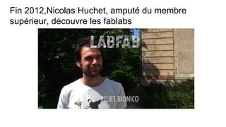 Fin 2012,Nicolas Huchet, amputé du membre
supérieur, découvre les fablabs
 