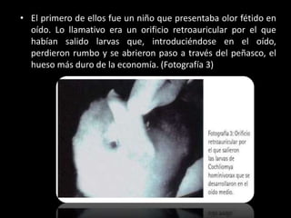 • El primero de ellos fue un niño que presentaba olor fétido en
oído. Lo llamativo era un orificio retroauricular por el que
habían salido larvas que, introduciéndose en el oído,
perdieron rumbo y se abrieron paso a través del peñasco, el
hueso más duro de la economía. (Fotografía 3)
 