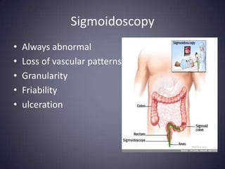 Sigmoidoscopy
•   Always abnormal
•   Loss of vascular patterns
•   Granularity
•   Friability
•   ulceration
 
