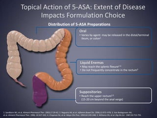 Topical Action of 5-ASA: Extent of Disease
                          Impacts Formulation Choice
                                                  Distribution of 5-ASA Preparations
                                                                                     Oral
                                                                                     • Varies by agent: may be released in the distal/terminal
                                                                                       ileum, or colon1




                                                                                      Liquid Enemas
                                                                                      • May reach the splenic flexure2-4
                                                                                      • Do not frequently concentrate in the rectum3




                                                                                     Suppositories
                                                                                     • Reach the upper rectum2,5
                                                                                       (15-20 cm beyond the anal verge)



1. Sandborn WJ, et al. Aliment Pharmacol Ther. 2003;17:29-42; 2. Regueiro M, et al. Inflamm Bowel Dis. 2006;12:972–978; 3. Van Bodegraven AA,
et al. Aliment Pharmacol Ther. 1996; 10:327-332; 4. Chapman NJ, et al. Mayo Clin Proc. 1992;62:245-248; 5. Williams CN, et al. Dig Dis Sci. 1987;32:71S-75S.
 