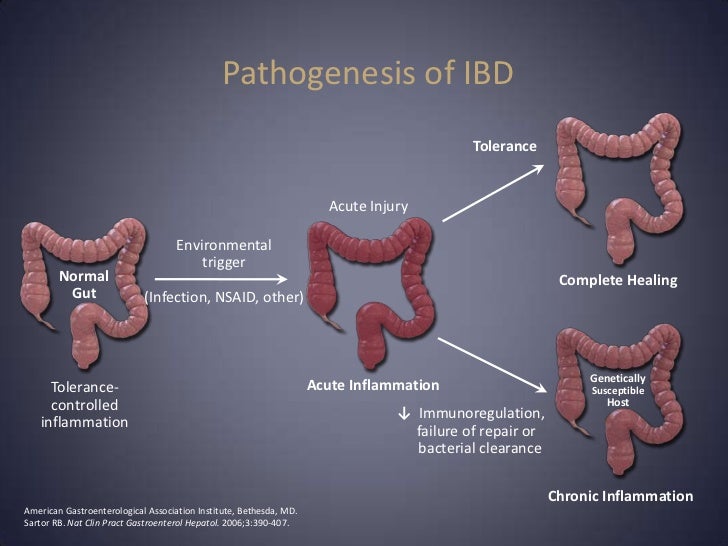Inflammatory bowel disease