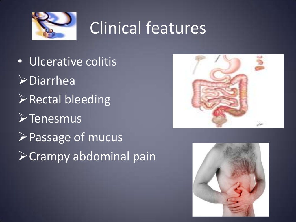 Inflammatory bowel disease