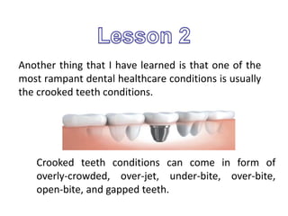Another thing that I have learned is that one of the
most rampant dental healthcare conditions is usually
the crooked teeth conditions.
Crooked teeth conditions can come in form of
overly-crowded, over-jet, under-bite, over-bite,
open-bite, and gapped teeth.
 