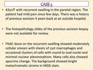 • 42yr/F with recurrent swelling in the parotid region. The
patient had mild pain since few days. There was a history
of previous excision 4 years back at an outside hospital.
• The histopathology slides of the previous excision biopsy
were not available for review.
• FNAC done on the recurrent swelling showed moderately
cellular smears with sheets of cyst macrophages and
occasional clusters of cells with round to oval nuclei and
minimal nuclear pleomorphism. Many cells also showed
apocrine change. The background showed bright
metachromatic stroma in MGG stain.
 