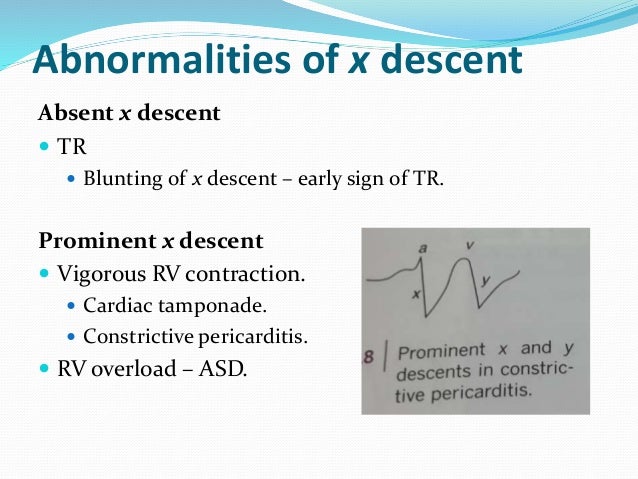 Jugular Venous Pressure Jugular Venous Pressure