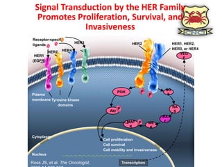 Management of Metastatic Her2 positive breast cancer | PPTX