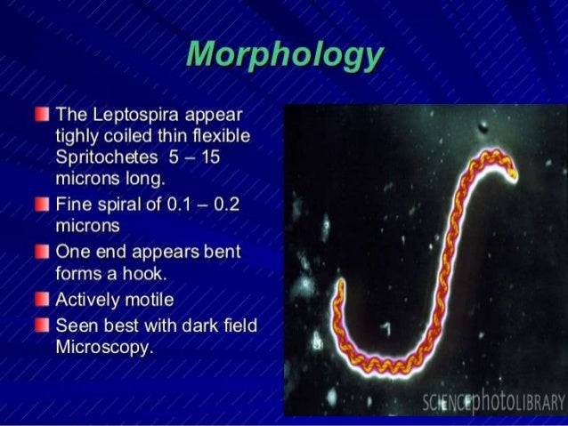 Leptospirosis