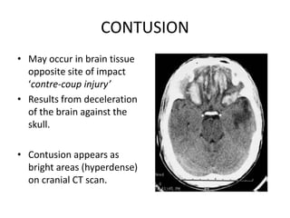 Management of head injury | PPTX