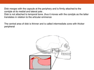 Disk merges with the capsule at the periphery and is firmly attached to the
condyle at its medial and lateral pole .
Disk is not attached to temporal bone ,thus it moves with the condyle as the latter
translates in relation to the articular eminence
The central area of disk is thinner and is called intermediate zone with thicker
peripheral
 