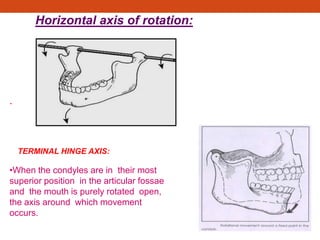Horizontal axis of rotation:
.
TERMINAL HINGE AXIS:
•When the condyles are in their most
superior position in the articular fossae
and the mouth is purely rotated open,
the axis around which movement
occurs.
 