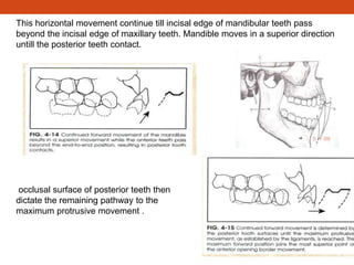 This horizontal movement continue till incisal edge of mandibular teeth pass
beyond the incisal edge of maxillary teeth. Mandible moves in a superior direction
untill the posterior teeth contact.
occlusal surface of posterior teeth then
dictate the remaining pathway to the
maximum protrusive movement .
 
