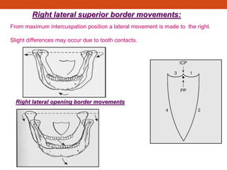 Right lateral superior border movements:
From maximum intercuspation position a lateral movement is made to the right.
Slight differences may occur due to tooth contacts.
Right lateral opening border movements
 