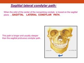 Sagittal lateral condylar path:
When the orbit of the center of the nonworking condyle is traced on the sagittal
plane ….SAGITTAL LATERAL CONDYLAR PATH.
This path is longer and usually steeper
than the sagittal protrusive condylar path.
 