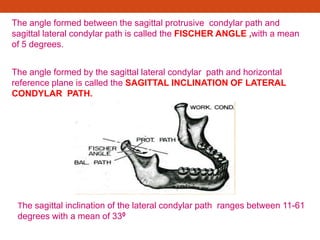The angle formed between the sagittal protrusive condylar path and
sagittal lateral condylar path is called the FISCHER ANGLE ,with a mean
of 5 degrees.
The angle formed by the sagittal lateral condylar path and horizontal
reference plane is called the SAGITTAL INCLINATION OF LATERAL
CONDYLAR PATH.
The sagittal inclination of the lateral condylar path ranges between 11-61
degrees with a mean of 330
 