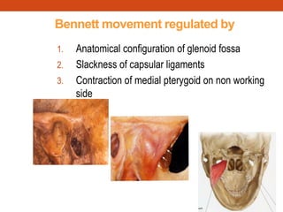 Bennett movement regulated by
1. Anatomical configuration of glenoid fossa
2. Slackness of capsular ligaments
3. Contraction of medial pterygoid on non working
side
 