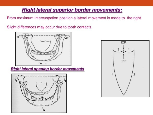 My mandibular movement final presentation My mandibular movement final presentation