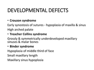 DEVELOPMENTAL DEFECTS
• Crouzon syndrome
Early synostosis of sutures - hypoplasia of maxilla & sinus
High arched palate
• Treacher Collins syndrome
Grossly & symmetrically underdeveloped maxillary
sinuses & malar bones
• Binder syndrome
Hypoplasia of middle third of face
Small maxillary length
Maxillary sinus hypoplasia
 